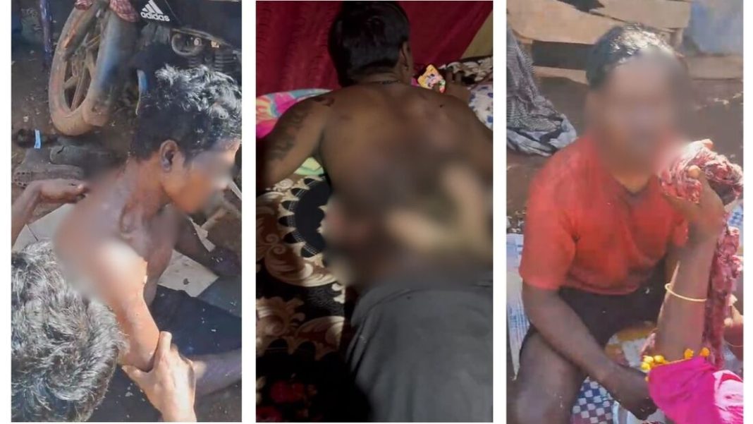 Police register suo moto case in burn victim’s death