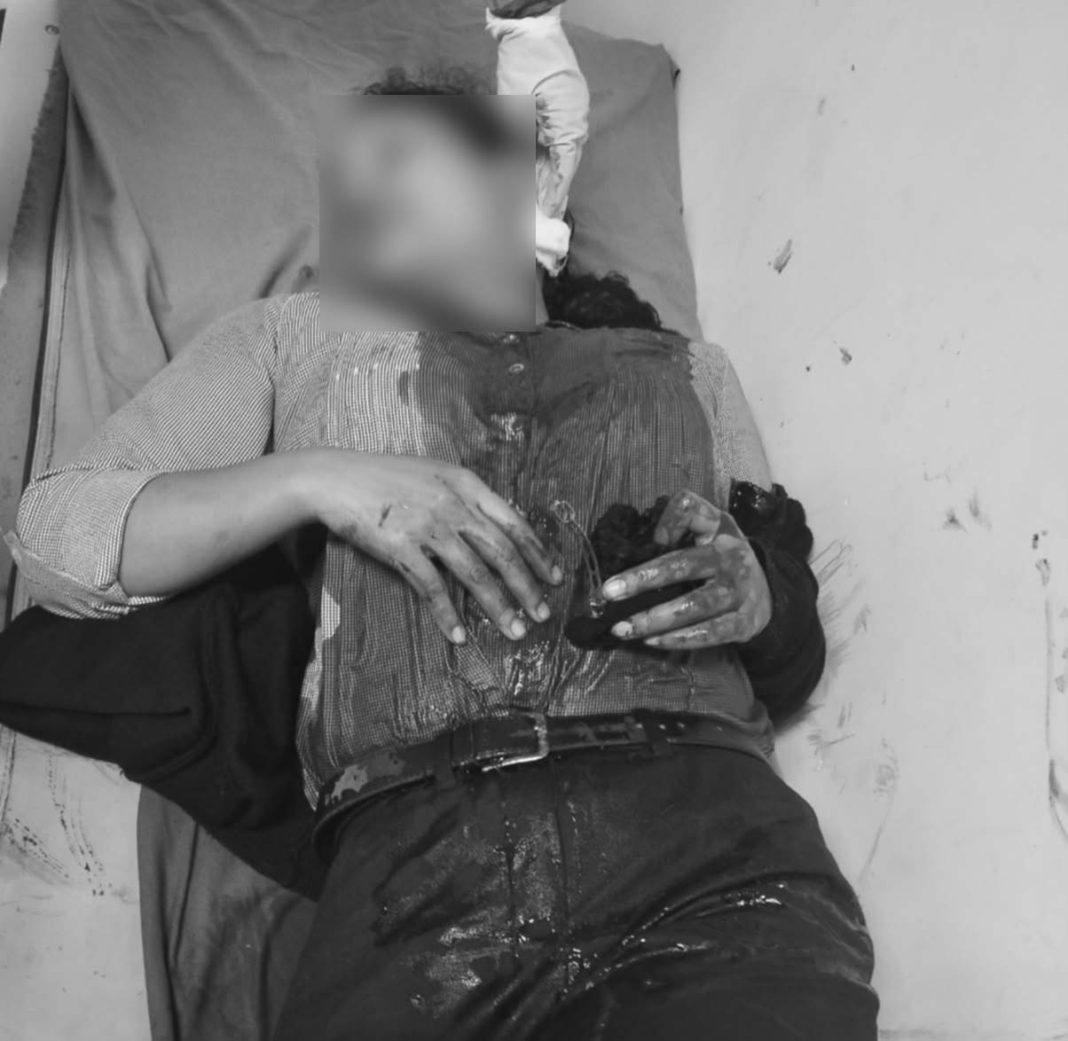 Woman injured after being robbed in Shillong